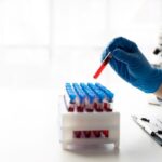 EUA podem aprovar exame de sangue para detectar cancer colorretal